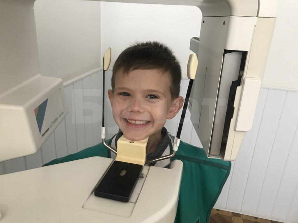 рентген детских зубов